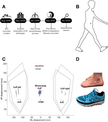 Case report: New perspectives on gait initiation strategies from a case of full toes amputation in a professional mountain climber